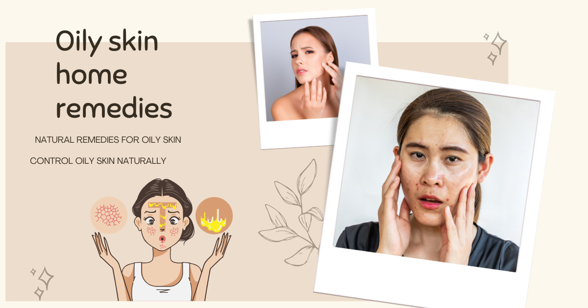 Best Home Remedies to Control Oily Skin Naturally