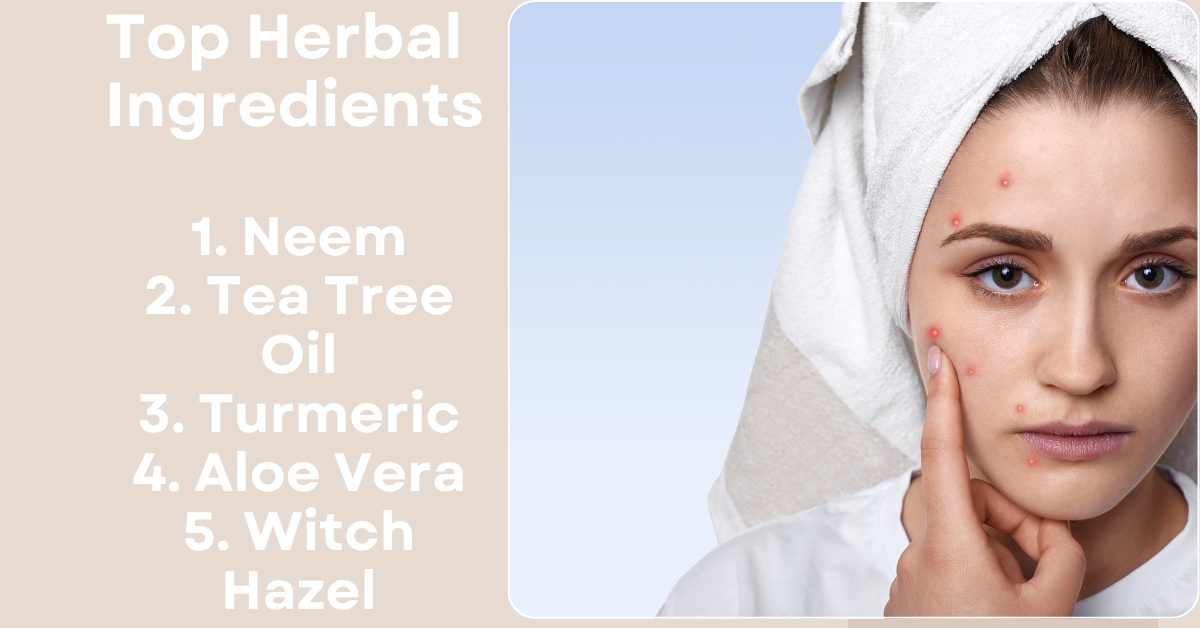 Herbal acne tretment