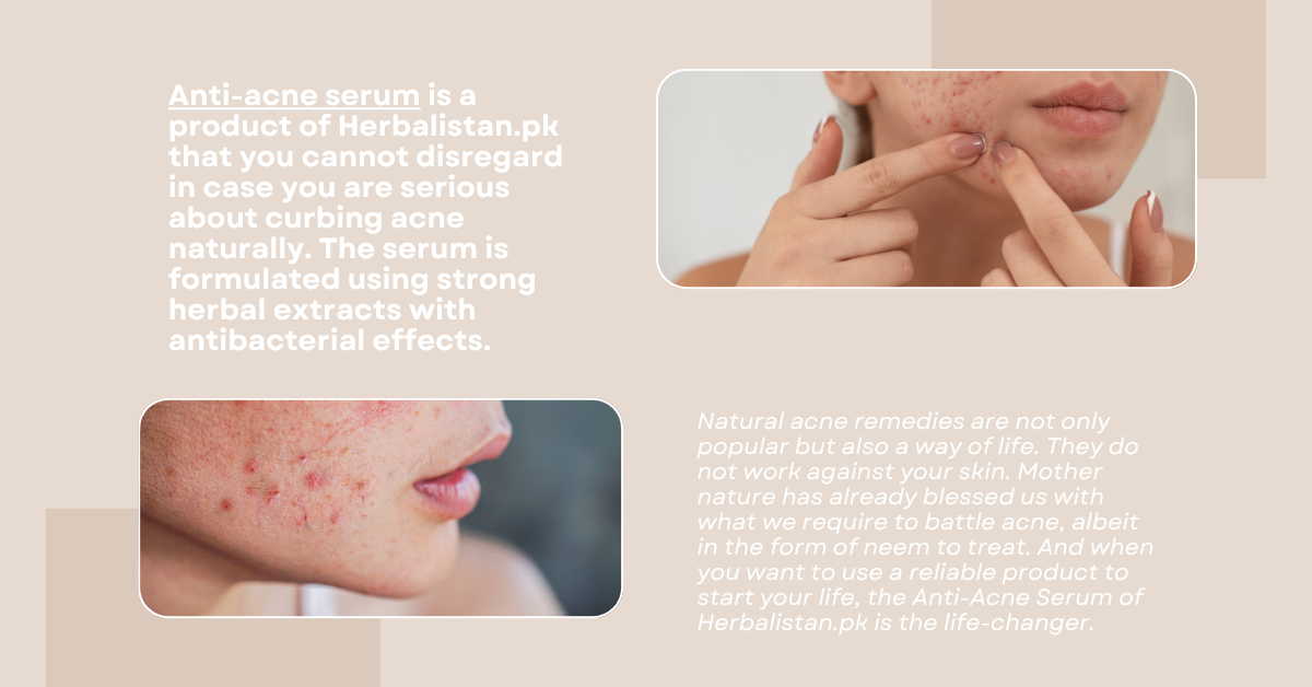 Herbal acne tretment